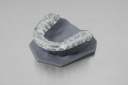 Dental LT透明樹脂 列印樣品 Form3 光固化3D列印機